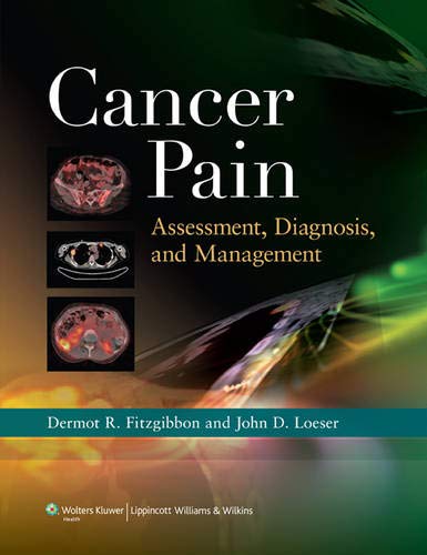 

surgical-sciences/oncology/cancer-pain-assessment-diagnosis-and-management-9781608310890