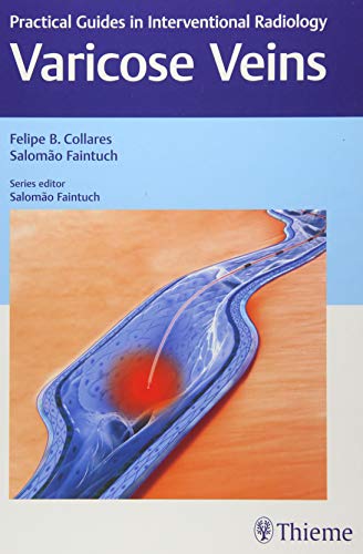 

exclusive-publishers/thieme-medical-publishers/varicose-veins-practical-guides-in-interventional-radiology-1-e--9781626230125