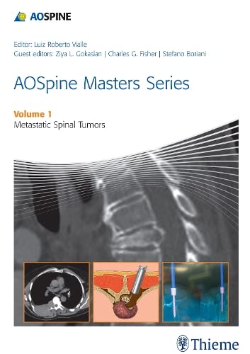 

exclusive-publishers/thieme-medical-publishers/ao-spine-masters-series-vol-1-metastatic-spinal-tumors--9781626230460
