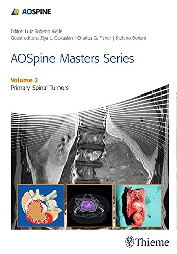 

exclusive-publishers/thieme-medical-publishers/aospine-masters-series-volume-2-primary-spinal-tumors--9781626230477