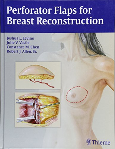 

exclusive-publishers/thieme-medical-publishers/perforator-flaps-for-breast-reconstruction--9781626230941