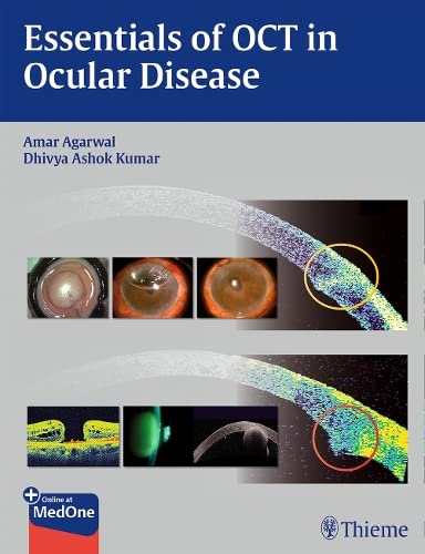 

exclusive-publishers/thieme-medical-publishers/essentials-of-oct-in-ocular-diseases-1-ed--9781626230989