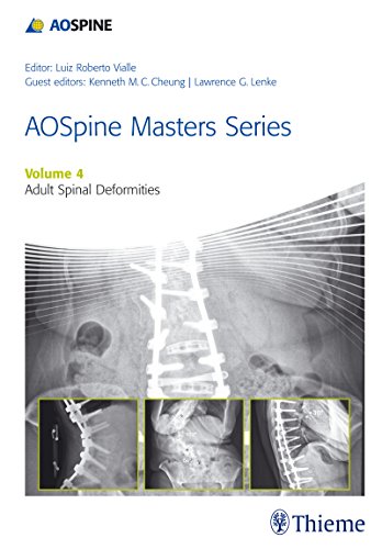 

exclusive-publishers/thieme-medical-publishers/aospine-master-series-vol-4-adult-spinal-deformities--9781626231009