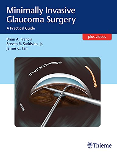 

exclusive-publishers/thieme-medical-publishers/minimally-invasive-glaucoma-surgery-a-practical-guide-1-e--9781626231566