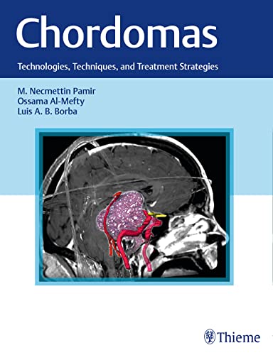 

exclusive-publishers/thieme-medical-publishers/chordomas-technologies-techniques-and-treatment-strategies-1-e--9781626231597