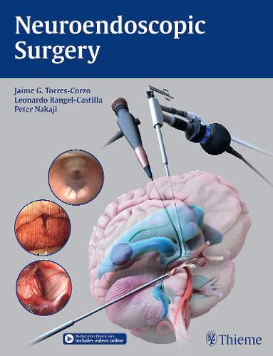 

exclusive-publishers/thieme-medical-publishers/neuroendoscopic-surgery-1-e--9781626231610