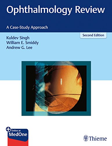

exclusive-publishers/thieme-medical-publishers/ophthalmology-review-a-case-study-approach-2-ed--9781626231764