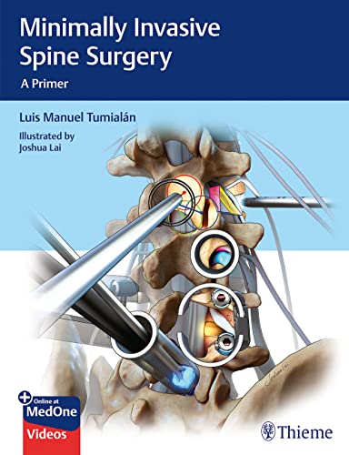 

exclusive-publishers/thieme-medical-publishers/minimally-invasive-spine-surgery-a-primer-1st-ed--9781626232181