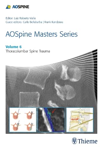 

exclusive-publishers/thieme-medical-publishers/aospine-masters-series-volume-6-thoracolumbar-spine-trauma--9781626232259