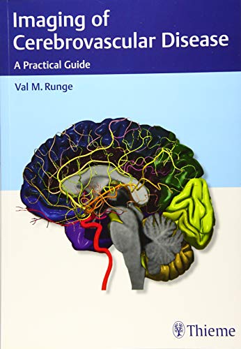 

exclusive-publishers/thieme-medical-publishers/imaging-of-cerebrovascular-disease-a-practical-guide-1-e--9781626232488