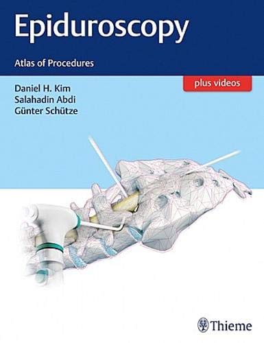 

exclusive-publishers/thieme-medical-publishers/epiduroscopy-atlas-of-procedures-1-e--9781626232662