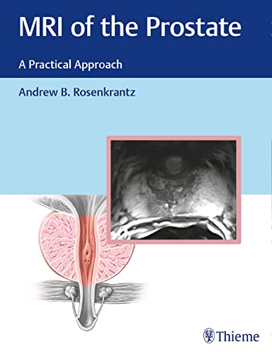 

exclusive-publishers/thieme-medical-publishers/mri-of-the-prostate-a-practical-approach-1-e--9781626232686