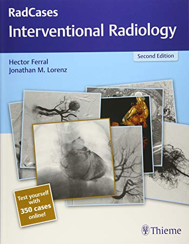 

exclusive-publishers/thieme-medical-publishers/radcases-interventional-radiology-2-ed--9781626232822