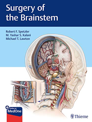 

exclusive-publishers/thieme-medical-publishers/surgery-of-the-brainstem--9781626232914