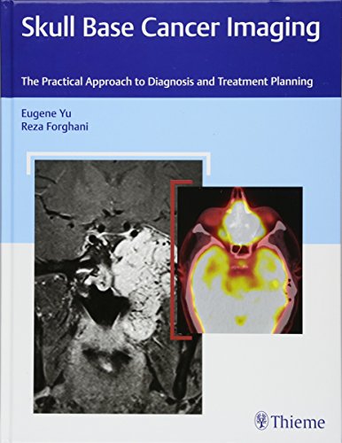 

exclusive-publishers/thieme-medical-publishers/skull-base-cancer-imaging-the-practical-approach-to-diagnosis-and-treatment-planning-1-e--9781626232969