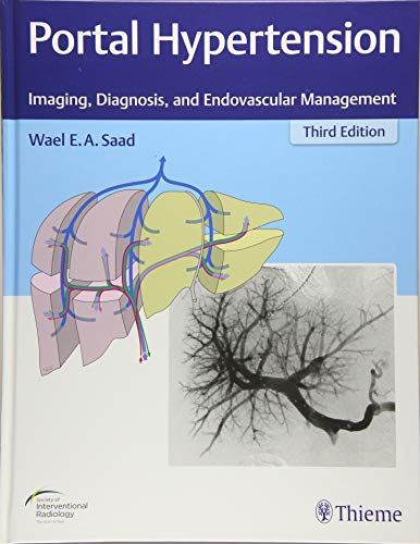 

exclusive-publishers/thieme-medical-publishers/portal-hypertension-imaging-diagnosis-and-endovascular-management-3-e--9781626233270