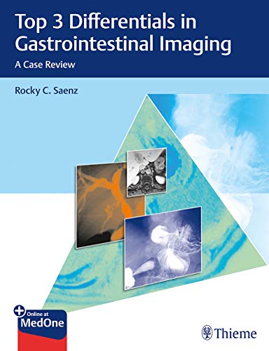 

exclusive-publishers/thieme-medical-publishers/top-3-differential-in-gastrointestinal-imaging-a-case-review-9781626233584