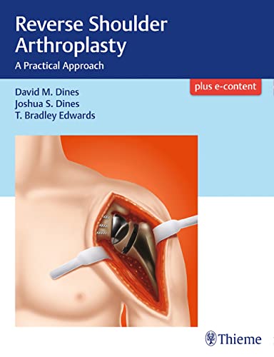

exclusive-publishers/thieme-medical-publishers/reverse-shoulder-arthroplasty-a-practical-approach-1-e--9781626233607