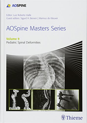 

exclusive-publishers/thieme-medical-publishers/aospine-masters-series-volume-9-pediatric-spinal-deformities--9781626234536