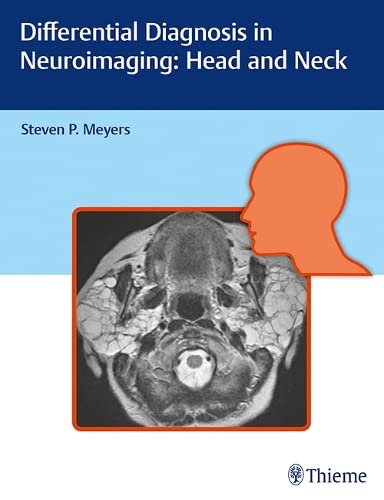 

exclusive-publishers/thieme-medical-publishers/differential-diagnosis-in-neuroimaging-head-and-neck-1-ed--9781626234758