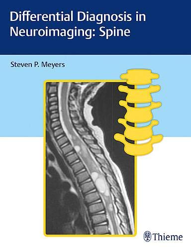 

exclusive-publishers/thieme-medical-publishers/differential-diagnosis-in-neuroimaging-spine-1-ed--9781626234772