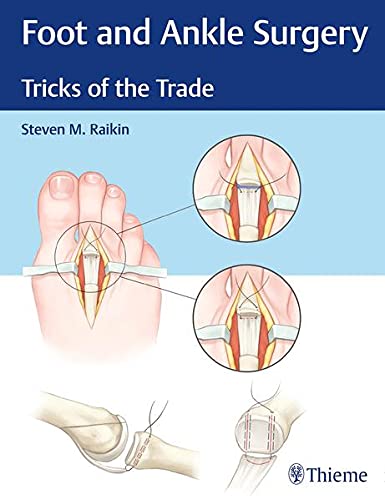 

exclusive-publishers/thieme-medical-publishers/foot-and-ankle-surgery-1-e--9781626234918