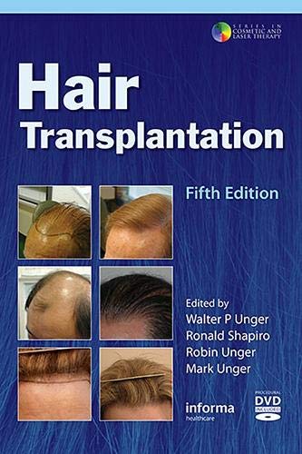 

general-books/general/hair-transplantation-5-e--9781626235700