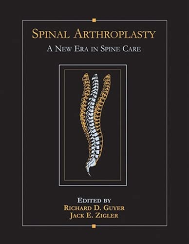 

exclusive-publishers/thieme-medical-publishers/spinal-arthroplasty-a-new-era-in-spine-care-9781626235939