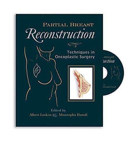 

exclusive-publishers/thieme-medical-publishers/partial-breast-reconstruction--9781626236172