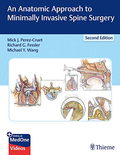 

exclusive-publishers/thieme-medical-publishers/an-anatomic-approach-to-minimally-invasive-spine-surgery-2-e--9781626236431