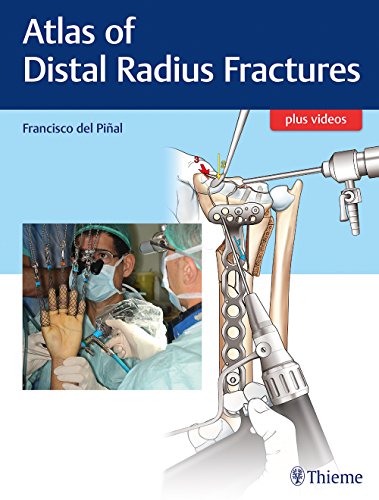 

exclusive-publishers/thieme-medical-publishers/atlas-of-distal-radius-fractures-1-e--9781626236790