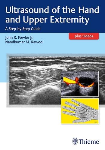 

exclusive-publishers/thieme-medical-publishers/ultrasound-of-the-hand-and-upper-extremity-a-step-by-step-guide-1-e--9781626236882