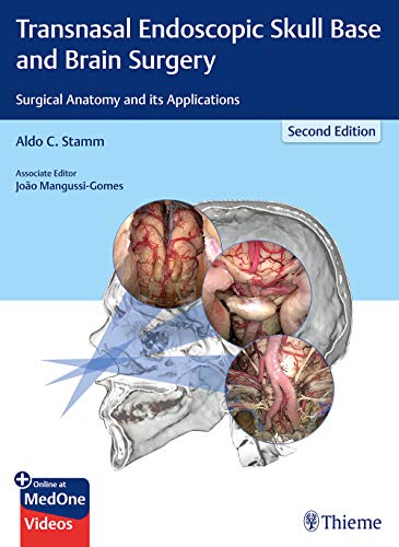 

general-books/general/transnasal-endoscopic-skull-base-and-brain-surgery-surgical-anatomy-and-its-applications-2-e--9781626237100