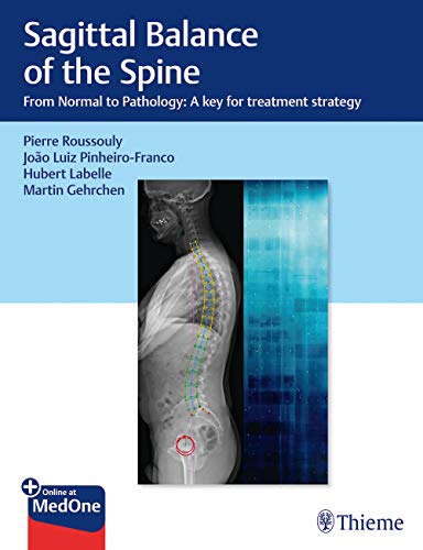 

exclusive-publishers/thieme-medical-publishers/sagittal-balance-of-the-spine-from-normal-to-pathology-a-key-for-treatment-strategy--9781626237322
