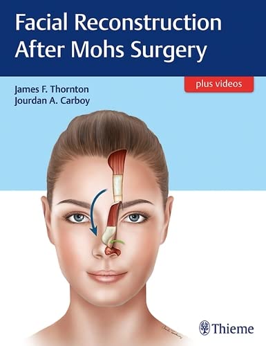 

exclusive-publishers/thieme-medical-publishers/facial-reconstruction-after-mohs-surgery-1-e--9781626237346