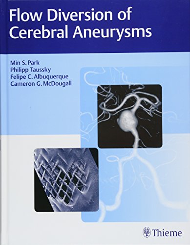

exclusive-publishers/thieme-medical-publishers/flow-diversion-of-cerebral-aneurysms-1-e--9781626237773