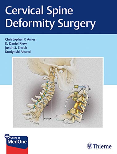 

exclusive-publishers/thieme-medical-publishers/cervical-spine-deformity-surgery--9781626239012