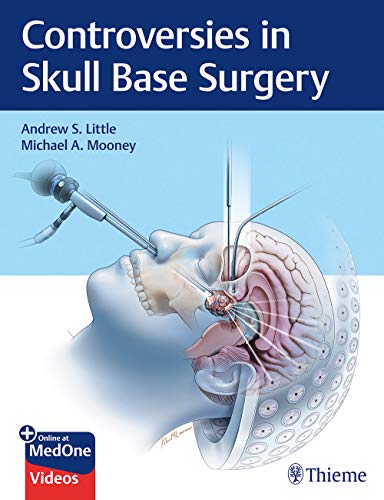 

exclusive-publishers/thieme-medical-publishers/controversies-in-skull-base-surgery--9781626239531