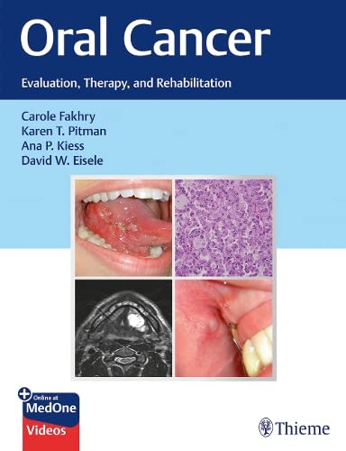 

exclusive-publishers/thieme-medical-publishers/oral-cancer-evaluation-theapy-and-rehabilitation--9781626239685