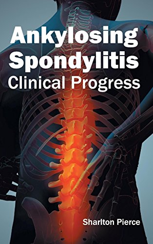 

surgical-sciences/orthopedics/ankylosing-spondylitis-clinical-progress-9781632410450
