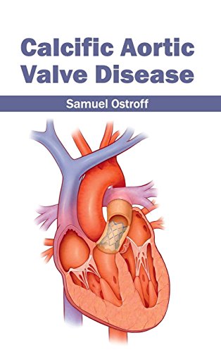 

clinical-sciences/cardiology/calcific-aortic-valve-disease-9781632410726