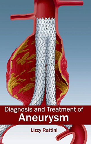 

surgical-sciences/nephrology/diagnosis-and-treatment-of-aneurysm-9781632411105