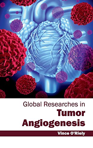 

basic-sciences/genetics/global-researches-in-tumor-angiogenesis-9781632412331