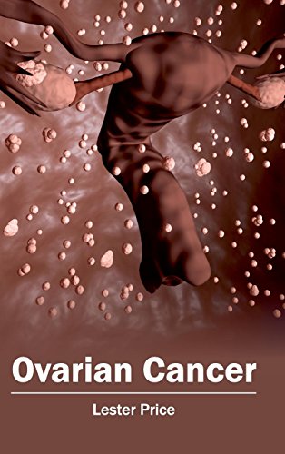 

surgical-sciences/oncology/ovarian-cancer--9781632413123