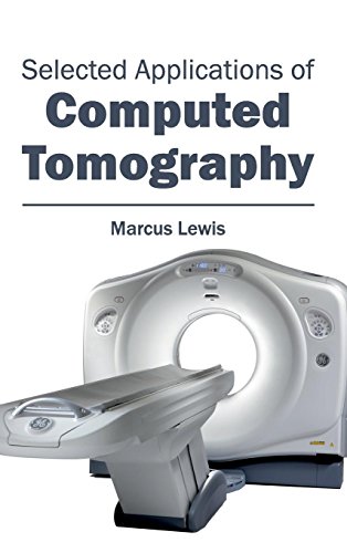 

clinical-sciences/radiology/selected-applications-of-computed-tomography-9781632413482