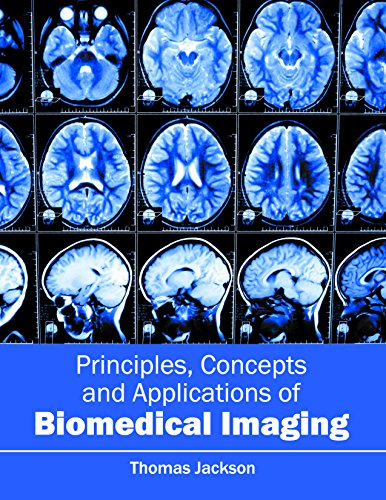 

clinical-sciences/radiology/principles-concepts-and-applications-of-biomedical-imaging-9781632413925