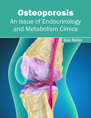 

clinical-sciences/endocrinology/osteoporosis-an-issue-of-endocrinology-and-metabolism-clinics-9781632414199