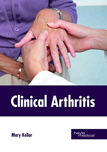 

surgical-sciences/orthopedics/clinical-arthritis-9781632414830