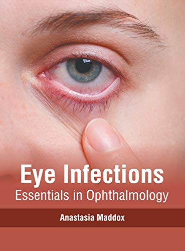 

surgical-sciences//eye-infections-essentials-in-ophthalmology--9781632417084