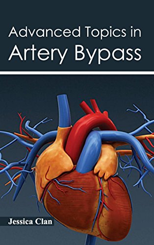 

clinical-sciences/cardiology/advanced-topics-in-artery-bypass-9781632420299